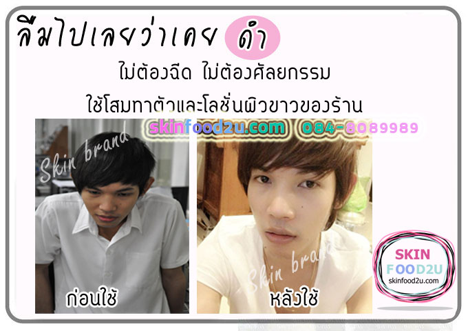 รีวิวครีมหน้าใส