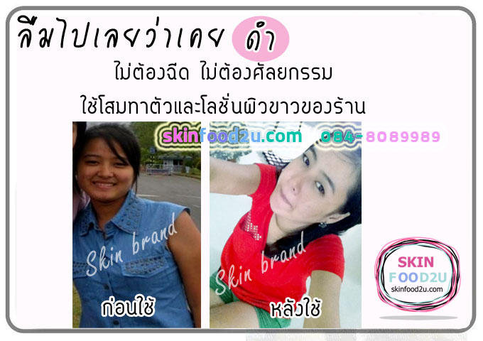 รีวิวโลชั่นฟักข้าว