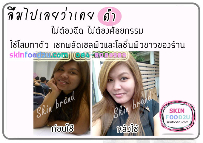 รีวิวครีมผิวขาว