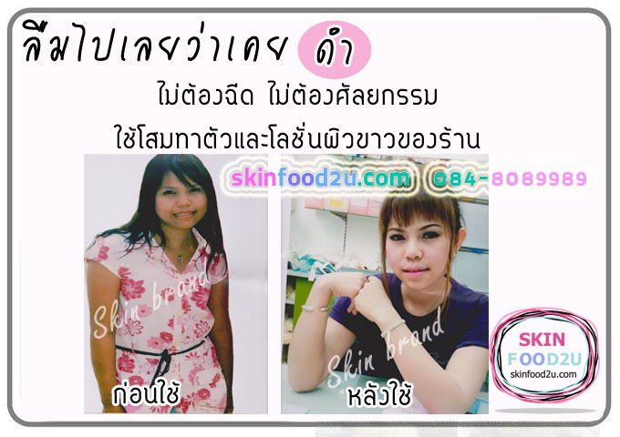 รีวิวครีมผิวขาว