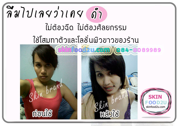 รีวิวโลชั่นโสม
