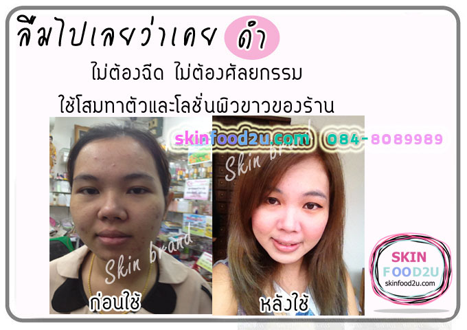 รีวิวคนใช้ครีมโสม